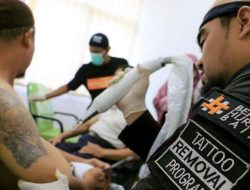 Puluhan Peserta Ikuti Program Hapus Tatto Gratis di Batam